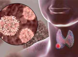 Tiroid nodüllerinde kanser riski ve uyarıları tiroid-nodllerinde-kanser-riski-ve-uyarlar