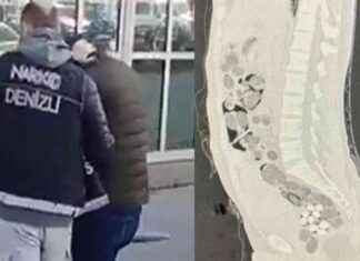 Yabancı yolcunun midesinden çıkan uyuşturucu miktarı şaşırtıcı yabanc-yolcunun-midesinden-kan-uyuturucu-miktar-artc