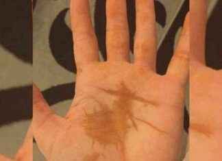 Elde Kına Lekesi Sabah Uyanınca Anlamı ve Geçişi elde-kna-lekesi-sabah-uyannca-anlam-ve-geii