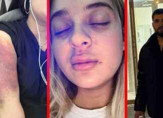 Esenyurt’ta Genç Kadına Kapıyı Kırıp Darbetti: Dehşet Anları! esenyurtta-gen-kadna-kapy-krp-darbetti-dehet-anlar