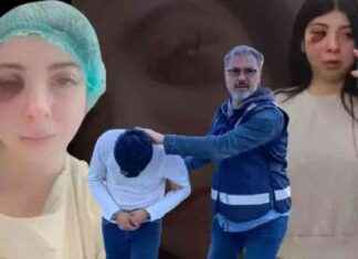 Samsun’da Sözlü Tacize Uğrayan Kadının Durumu Güncellendi samsunda-szl-tacize-urayan-kadnn-durumu-gncellendi